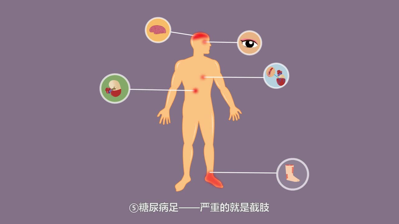 二維MG類樣片